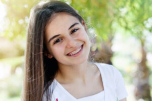 Read more about the article Ceramic Braces Treatment in London