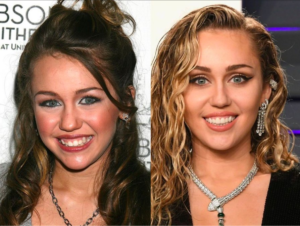 miley cyrus overbite