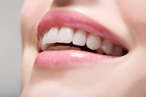 Read more about the article Gum recession