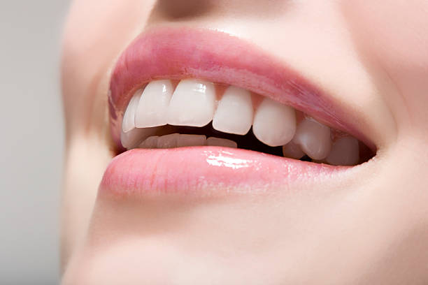 women-receding-gums-picture