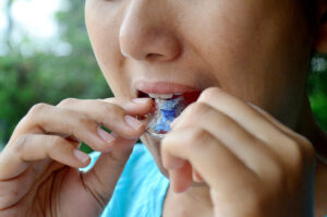 Read more about the article Permanent Retainer Broke: What To Do?