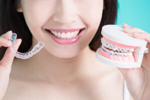 Read more about the article How much do braces cost for kids and adults?