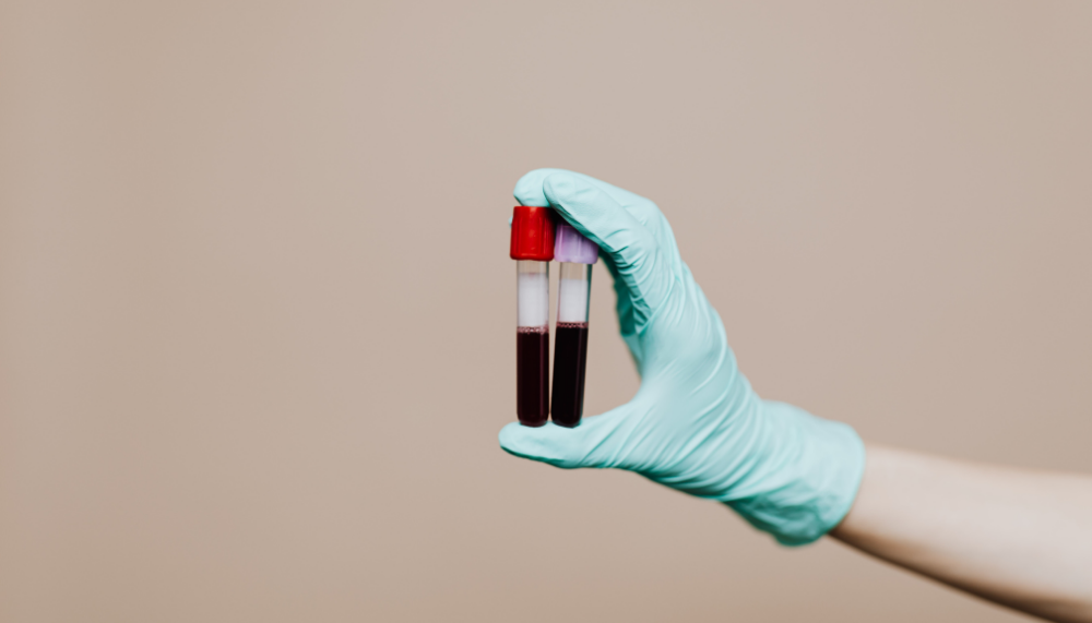 Read more about the article Get fast, accurate blood analysis at KIC’s Laboratory